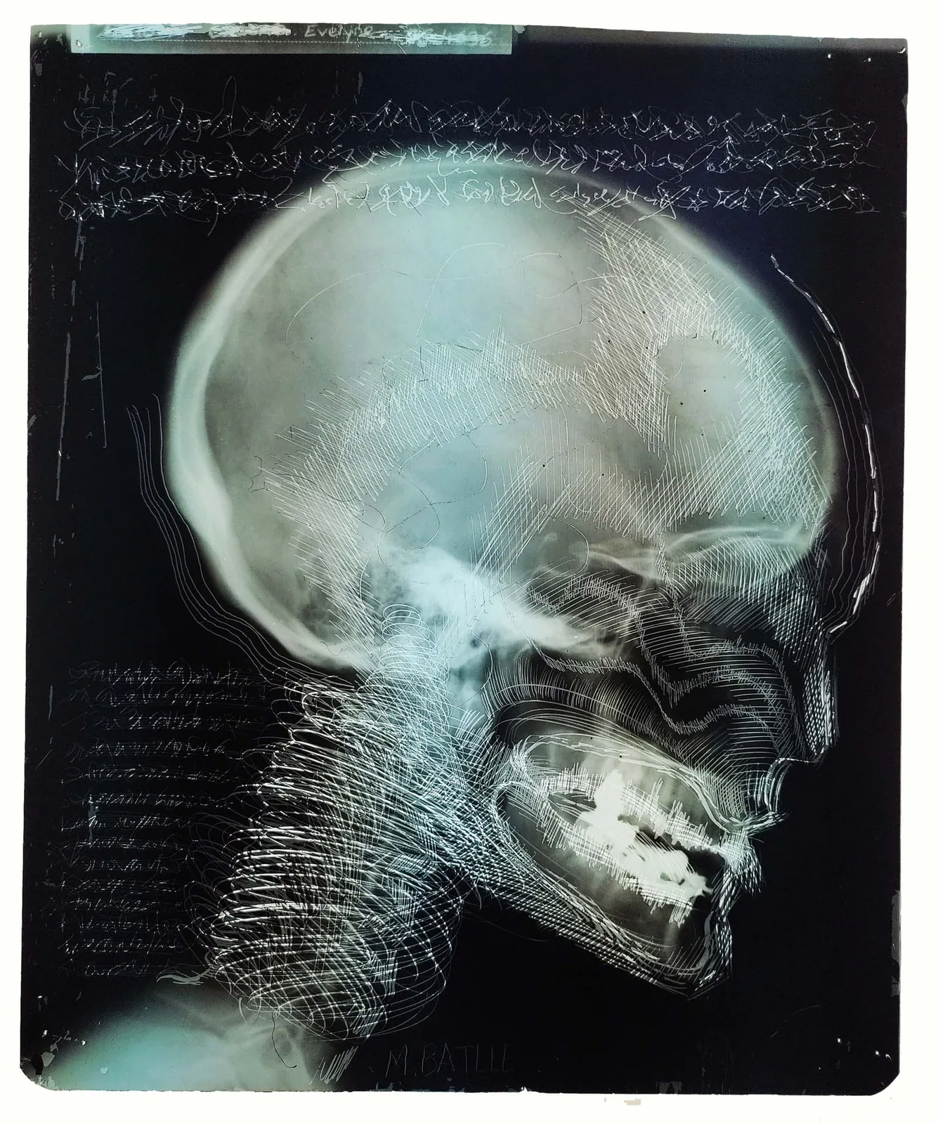 Radiogravure — 1970
